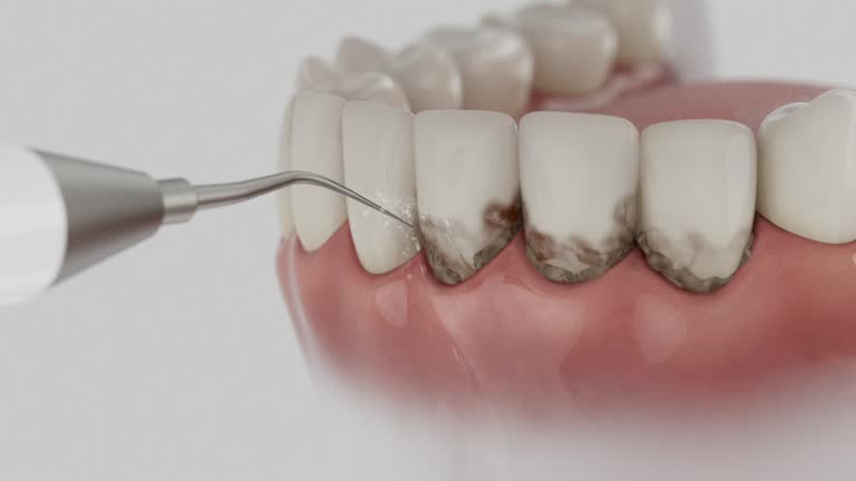 Reliable Dental contractor in Gloster, MS by Smile Center Dentistry